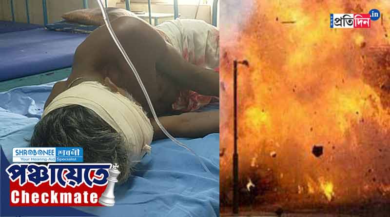 Panchayat Election 2023: পঞ্চায়েতের ফলপ্রকাশের মাঝে ময়নায় তীব্র বিস্ফোরণ, উড়ল বৃদ্ধের হাত