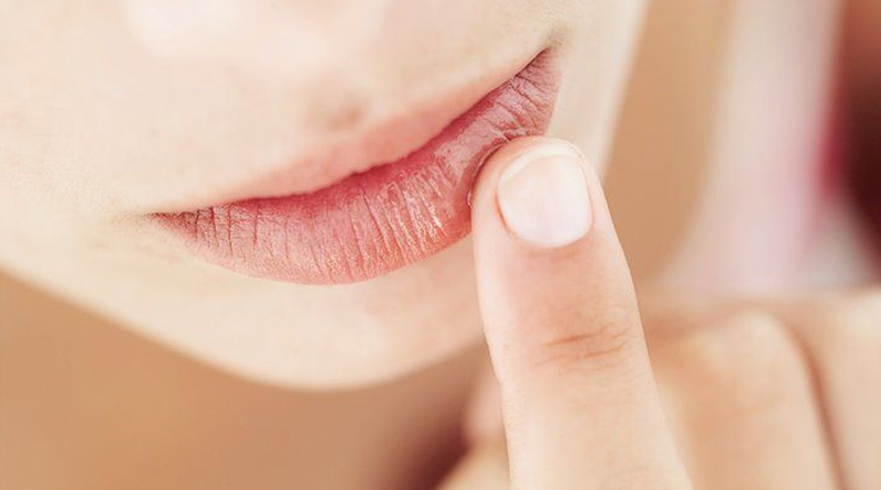 Try this Homemade lip balm| Sangbad Pratidin