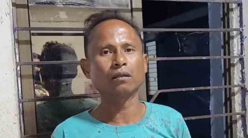 ঠাট্টার সাজা! কামড়ে বন্ধুর আঙুল ছিঁড়লেন SSB জওয়ান, পালটা বুকে দাঁত বসালেন যুবক