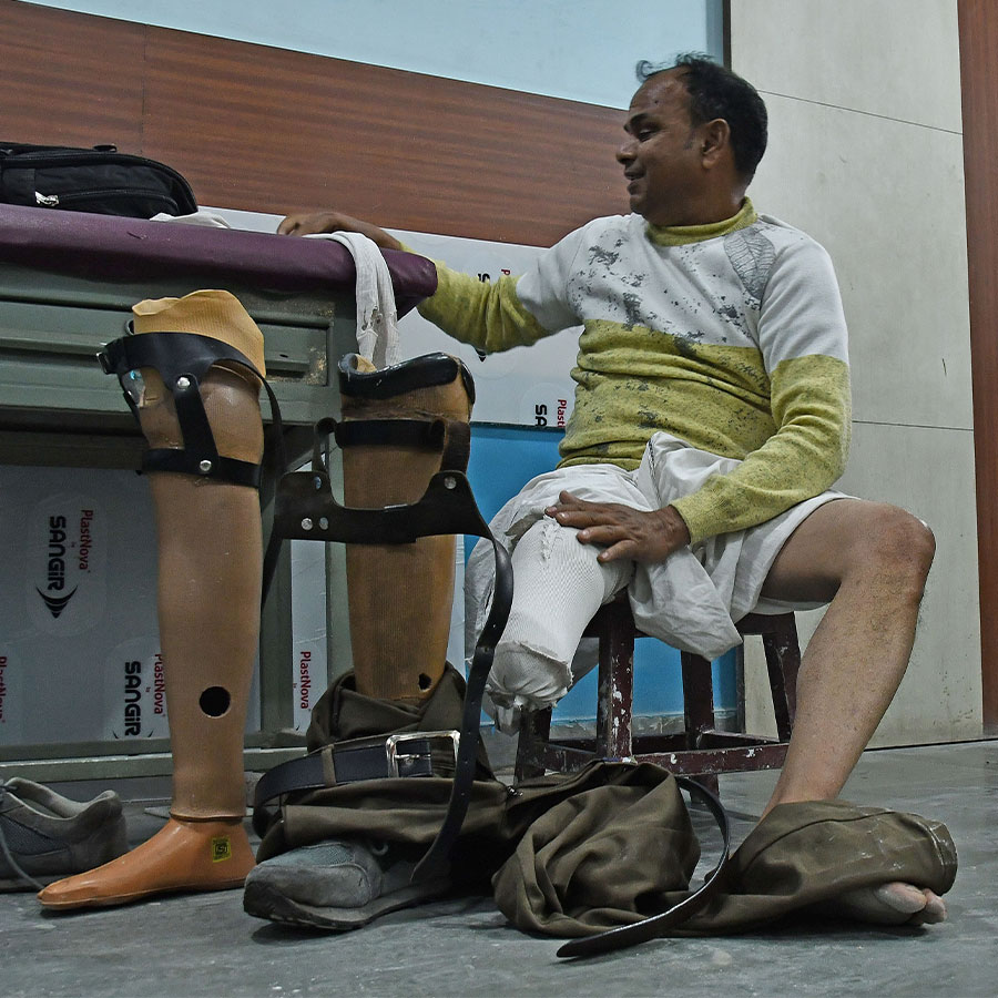 Exclusive: Hands and Feet factory in Kolkata! specially abled people make Prosthetic limbs 2
