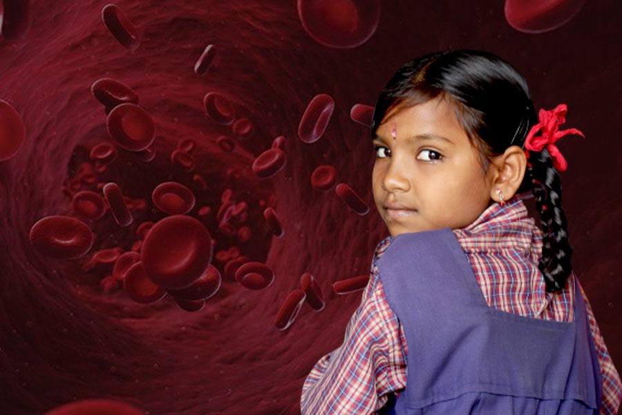 Anemia is a real problem for children, know about it's cause and care | Sangbad Pratidin