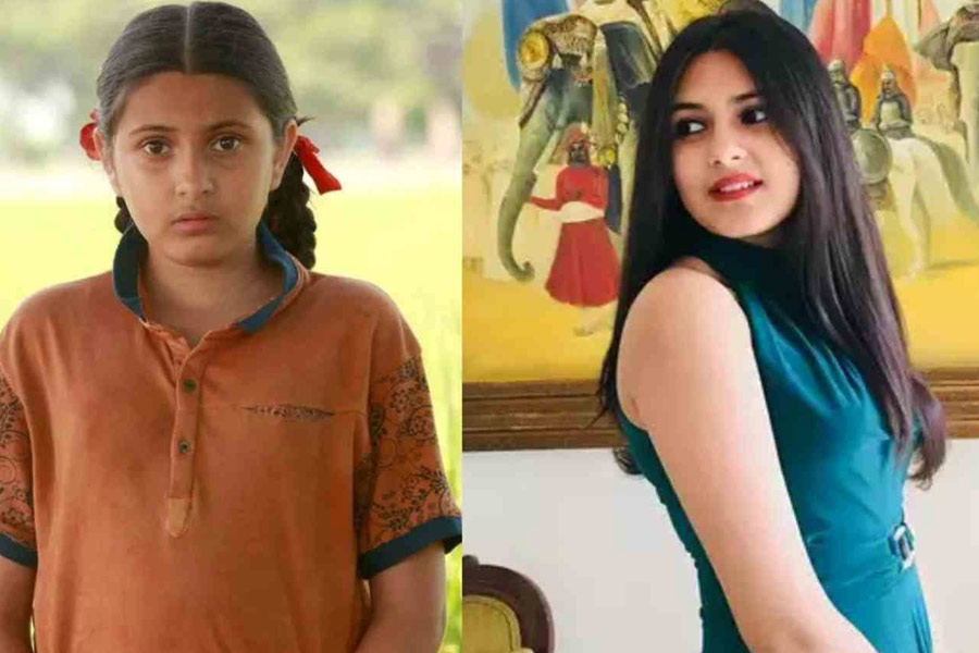 ডার্মাটোমায়োসাইটিসে ১৯ বছরেই মৃত্যু সুহানির, কী এই রোগ? কেন হয়? চিকিৎসাই বা কী?