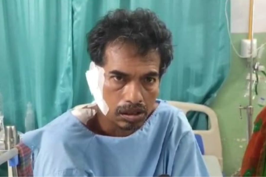 Tiger attack on a man in Sundarbans Jagdish mandal recovers after long treatment
