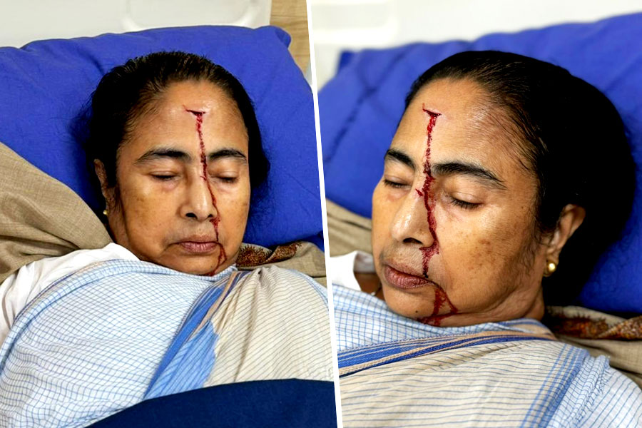 CM Mamata Banerjee gets injured and admitted to SSKM