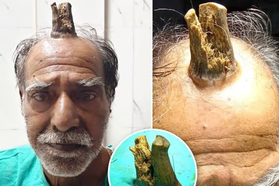 বৃদ্ধের মাথায় কীভাবে গজাল শিং! ছবি দেখে ভেবে কূল পাচ্ছে না নেটিজেনরা