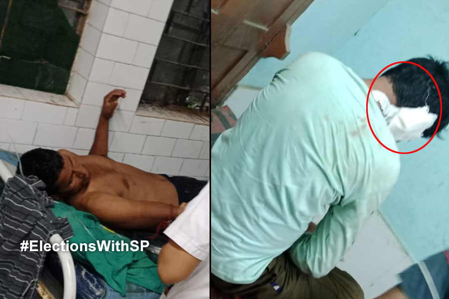 2024 Lok Sabha Election: BJP Worker attacked and his ear cut in Bhagabanpur, East Midnapore, TMC accused