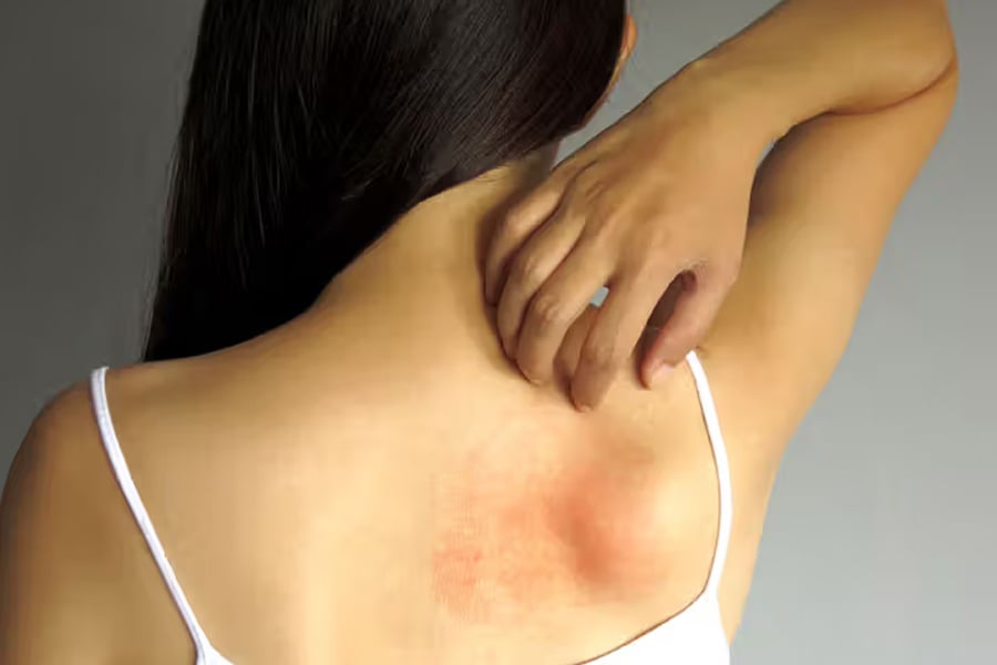 Know about Vasculitis and it's cure, expert gave Health Tips
