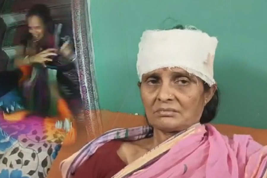 ফের দুষ্কৃতী তাণ্ডব বরানগরে! দিনের আলোয় ছিনতাই, রক্তাক্ত বৃদ্ধা