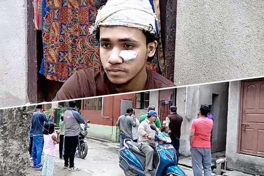 বাংলাদেশে রক্তাক্ত বেলঘরিয়ার যুবক! প্রাণ হাতে ‘দেশে’ ফিরলেন সায়ন