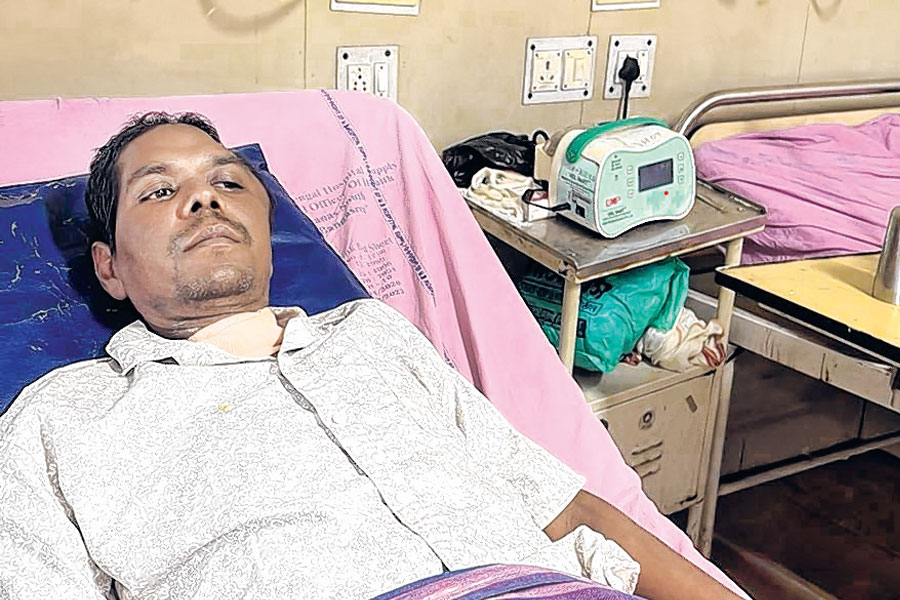 ৫০ দিন ভেন্টিলেশনে, কোমাচ্ছন্ন যুবকের পুনর্জন্ম এম আর বাঙুর হাসপাতালে