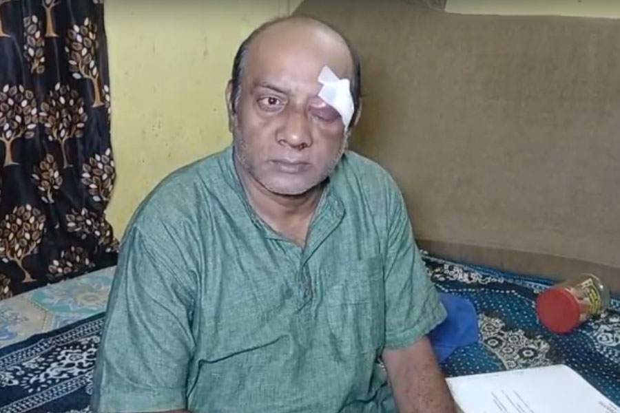 দলীয় সিদ্ধান্তের বিরোধিতা, দুষ্কৃতী ভাড়া করে খড়দহে সিপিএম কর্মীকে ‘মারধর’, অভিযুক্ত দলেরই নেতারা