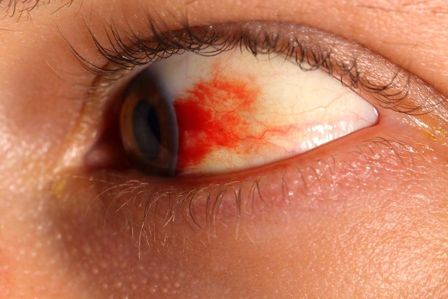If you are suffering from 'diabetic retinopathy', then take these precautions