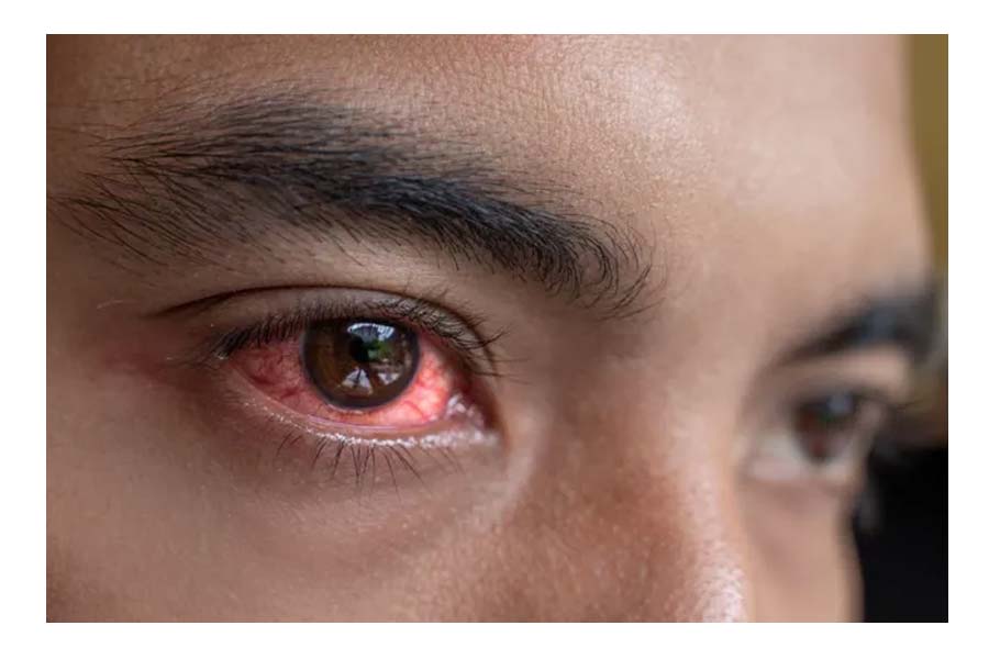 Kali Puja 2025: How to be careful not to damage your eyes while burning firecrackers