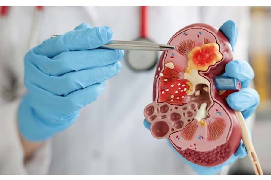 Frequent urination: A sign of serious illness