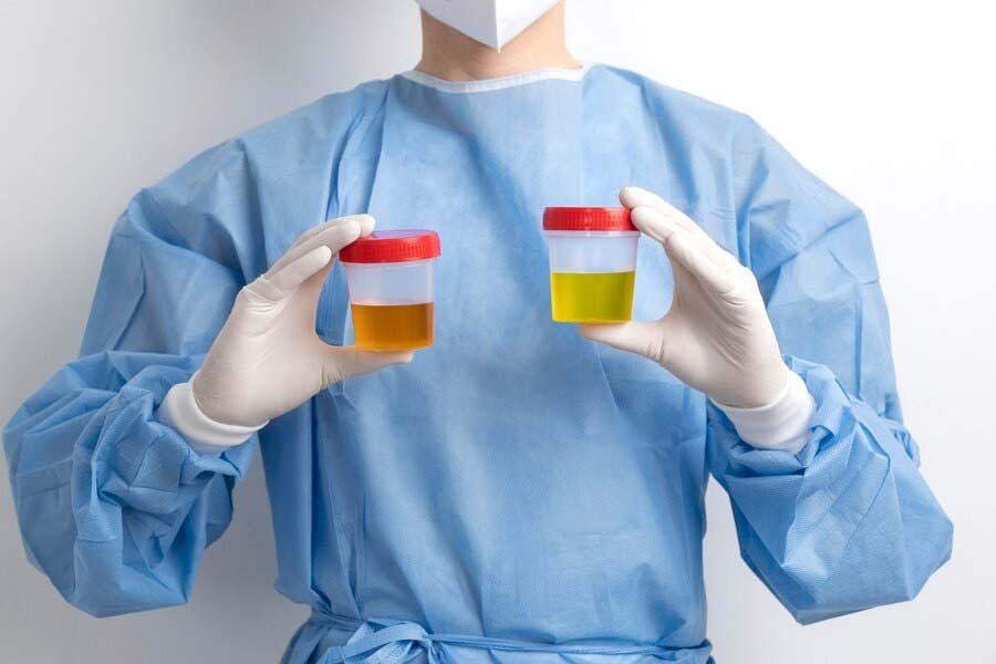 Frequent urination: A sign of serious illness