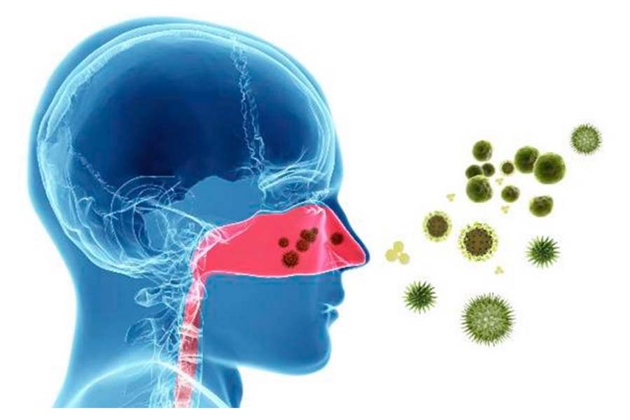 Symptoms and Remedies for Allergic Rhinitis