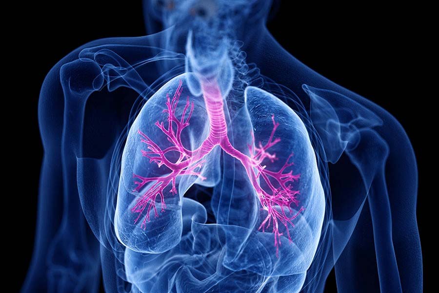 Asthma Treatment