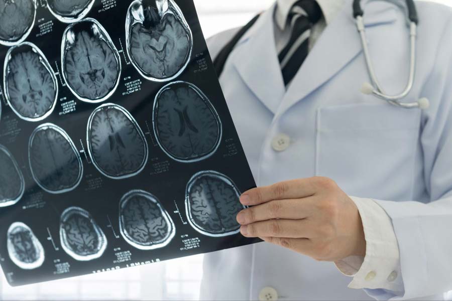 Research claims that dental problems increase the risk of ischemic stroke