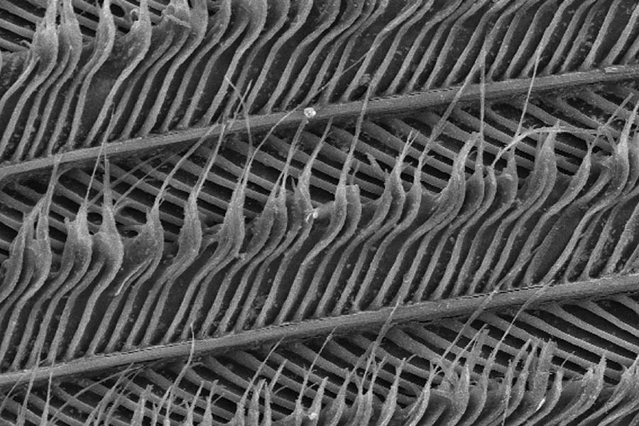 King's College London developed an enamel-rebuilding, keratin-based toothpaste from hair