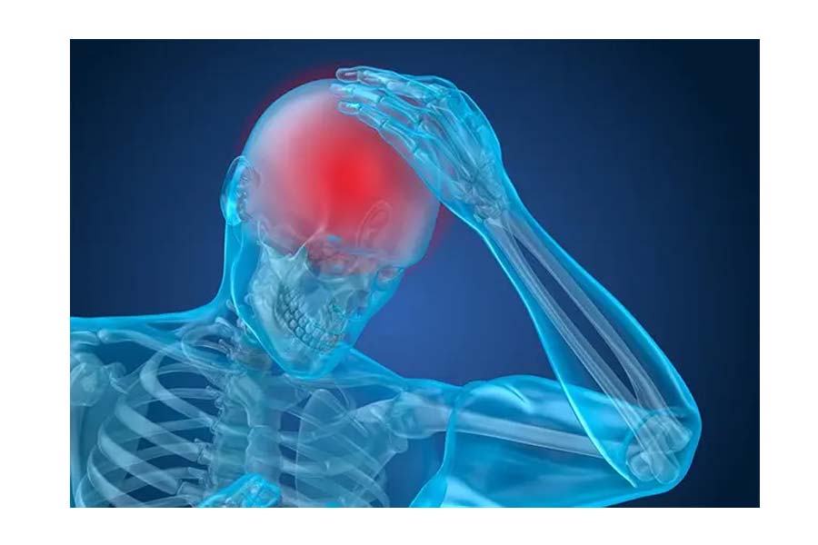 Silent Stroke: Definition, Causes, and Prevention