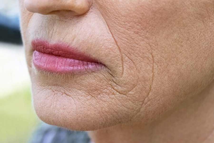 Skin-Aging