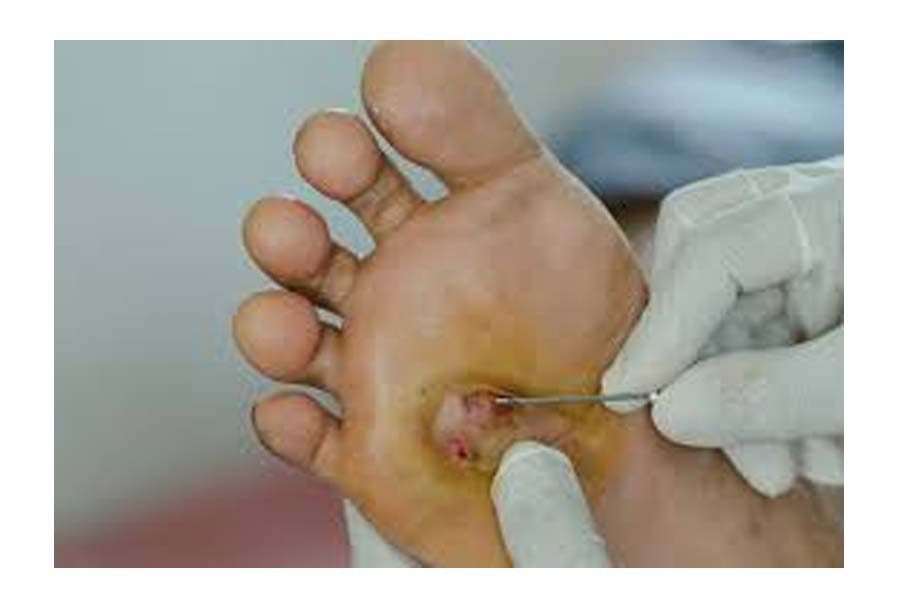 Foot care tips for winter