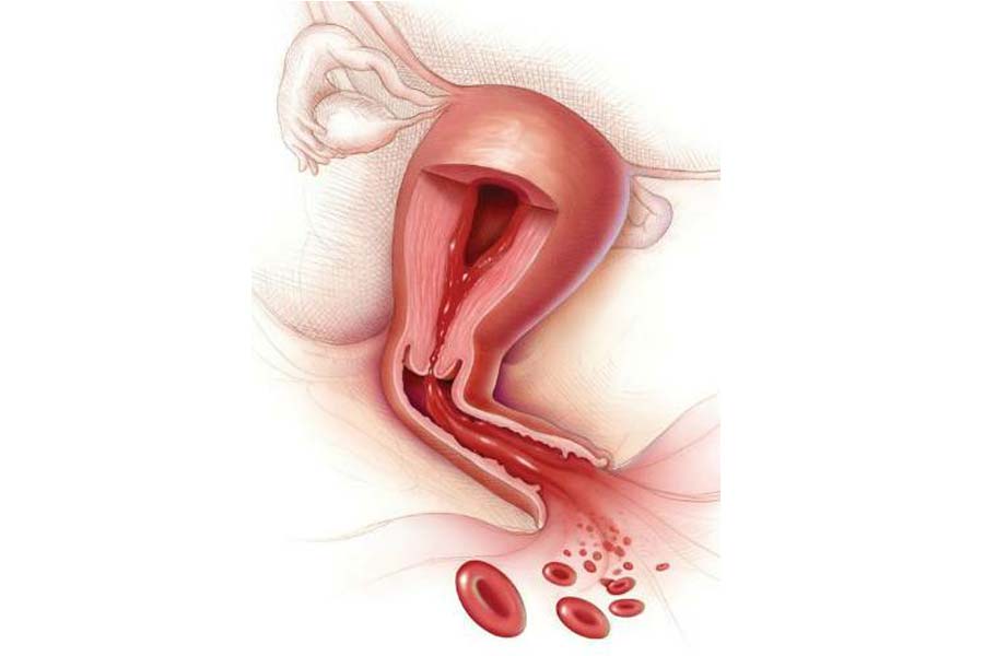 Prolonged periods can lead to serious health issues  