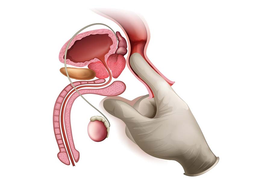 PSA Tests Curb Prostate Cancer Risk