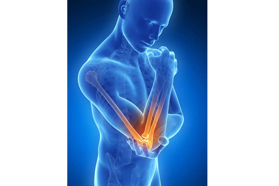 Tennis Elbow Symptoms and Remedies