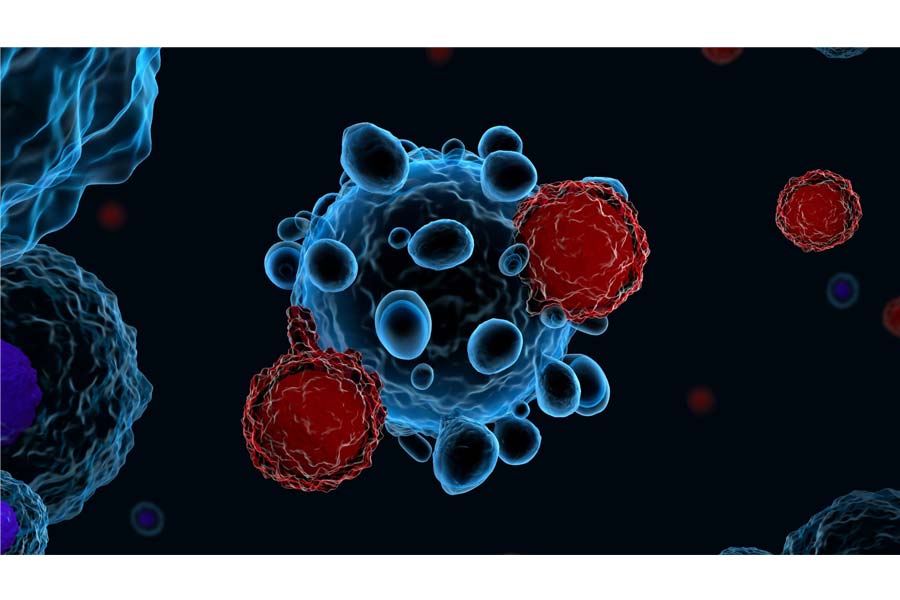 Advanced CAR T-cell therapy is pioneering cancer treatment