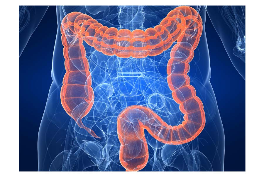 Red meat Colon Cancer fears are misleading; doctors clarify the evidence
