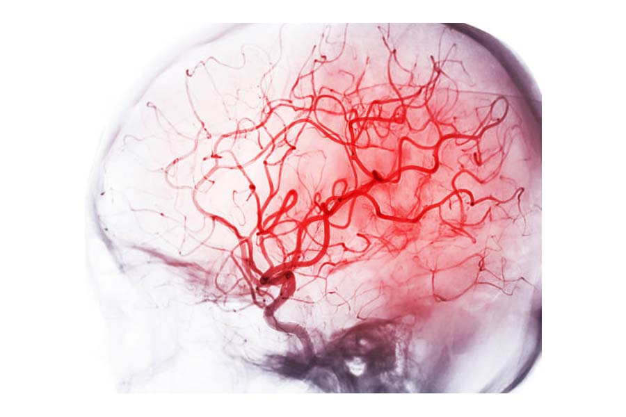 Neurologist decodes Deepinder Goyal’s 'Temple' and its brain-aging claims