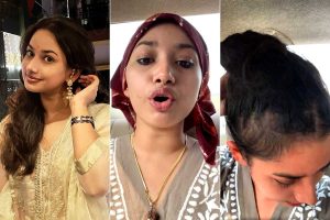 আচমকা রাজন্যা হালদারের মাথা ভর্তি জটা! সত্যিই ঈশ্বরের আশীর্বাদ? কী বলছেন বিশেষজ্ঞরা?