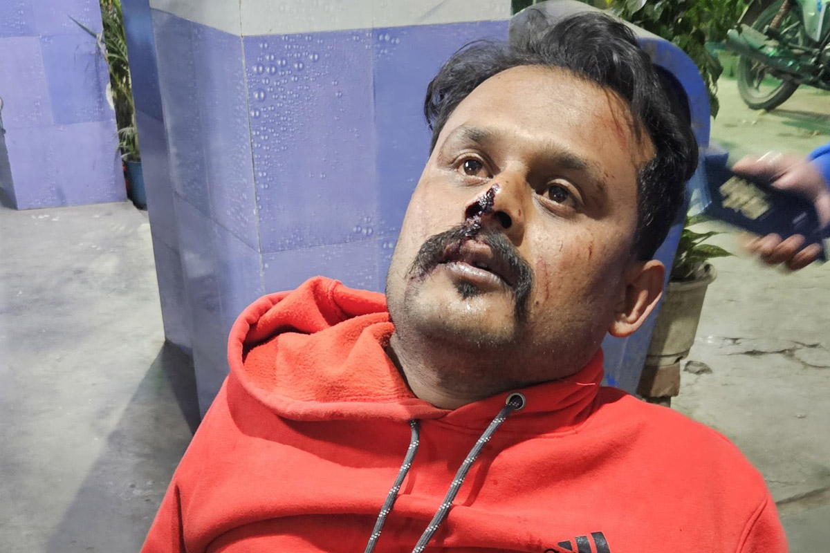 Baidyabati heated up in TMC-BJP clash
