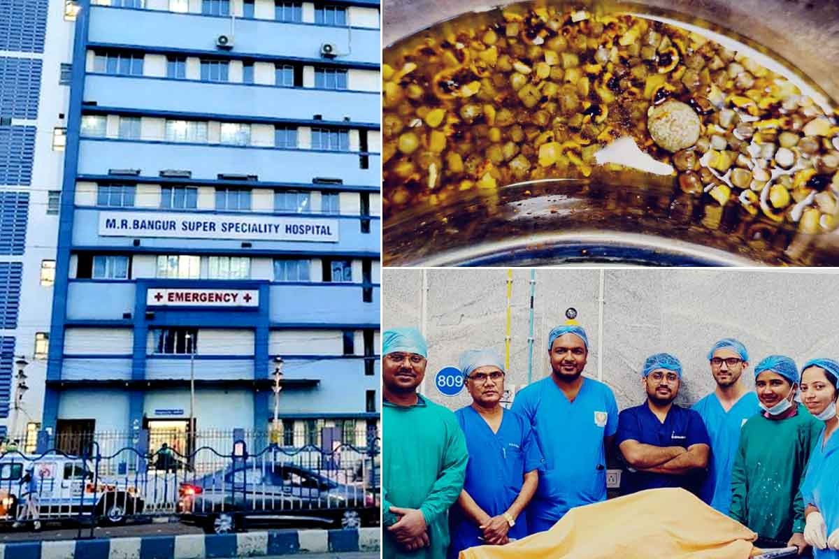 পেটে দু’হাজার পাথর! সরকারি হাসপাতালের অস্ত্রোপচারে প্রাণ বাঁচল ৭৫ বছরের বৃদ্ধার