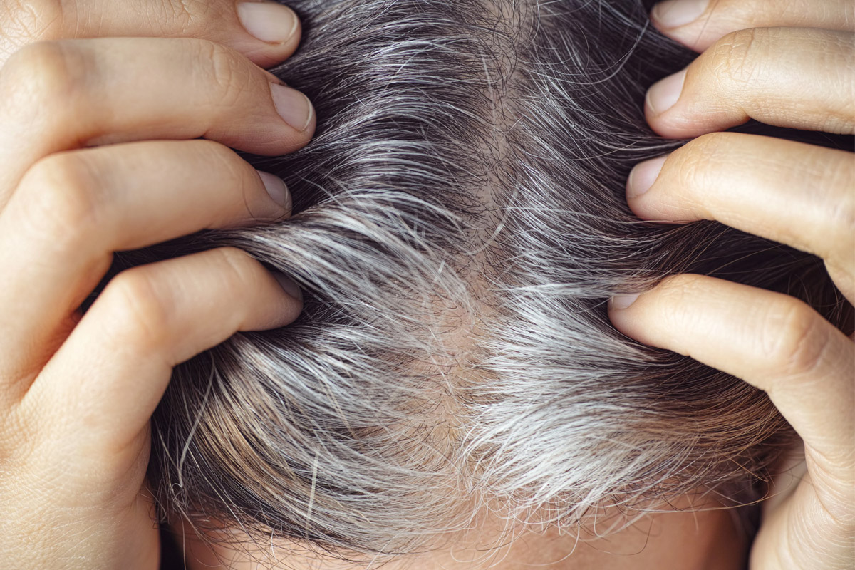 home remedy for grey hair