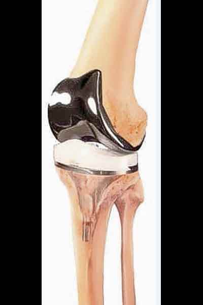 Knee