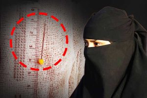 বোরখার পিন শ্বাসনালিতে ঢুকে প্রাণ সংশয় কিশোরীর, কলকাতা মেডিক্যালে গিয়ে রক্ষা