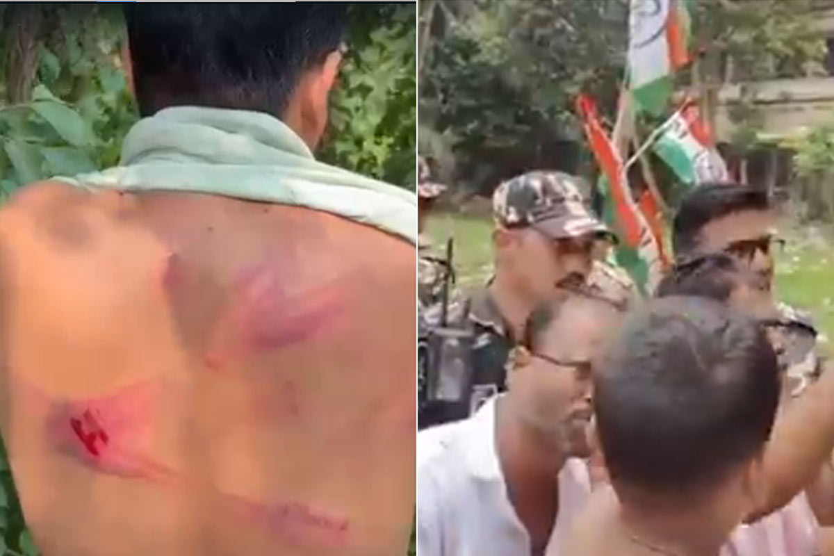 কেন্দ্রীয় বাহিনীর লাঠির ঘায়ে আহত ভোটার থেকে শিশু! ‘শাহের জল্লাদ বাহিনী’, তোপ মহুয়ার