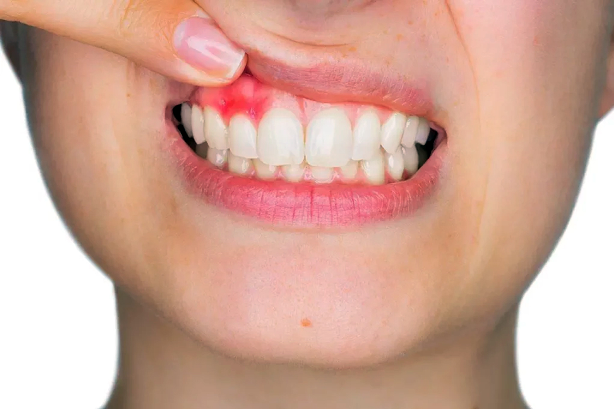 why indians avoid dentist despite dental problems