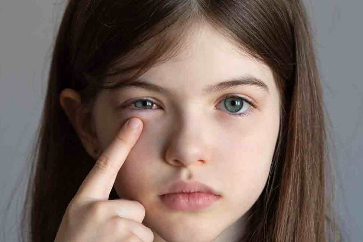 extreme heat eye damage double risk how to protect eye care tips