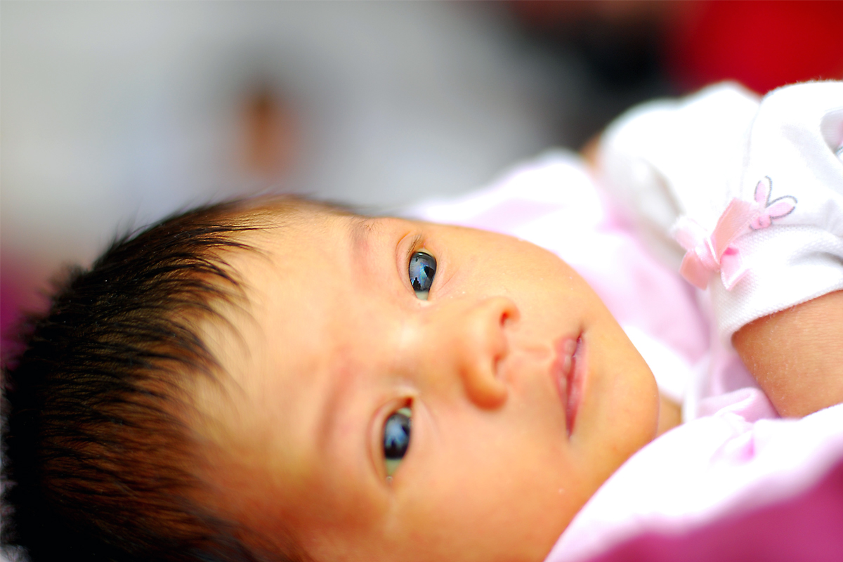 newborn jaundice warning brain damage risk doctors advice