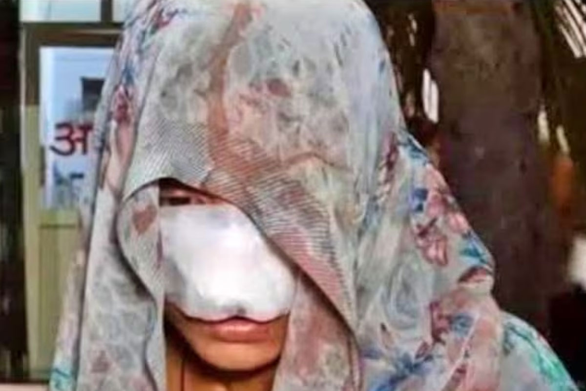 দাম্পত্য কলহের জের, রাগের চোটে স্ত্রীর নাক কামড়ে ছিঁড়ে দিলেন স্বামী! তারপর…