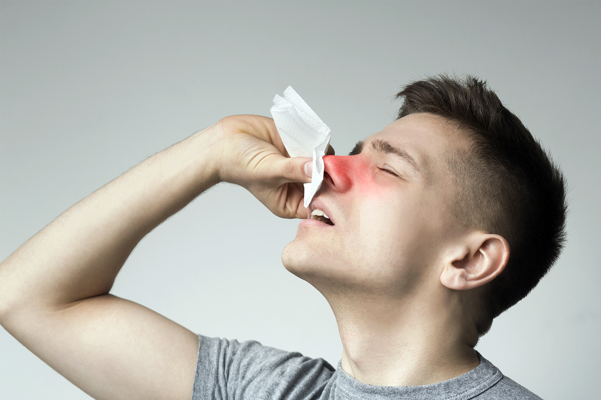 why nosebleeds increase in summer causes and prevention