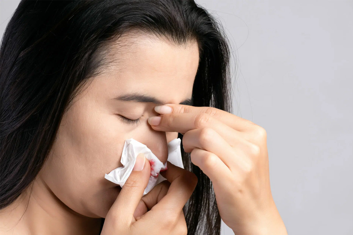 why nosebleeds increase in summer causes and prevention