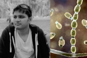 ক্যালিফোর্নিয়ায় ‘ভ্যালি ফিভার’-এ মৃত্যু ভারতীয়র, কতটা বিপজ্জনক এই বিরল জ্বর?