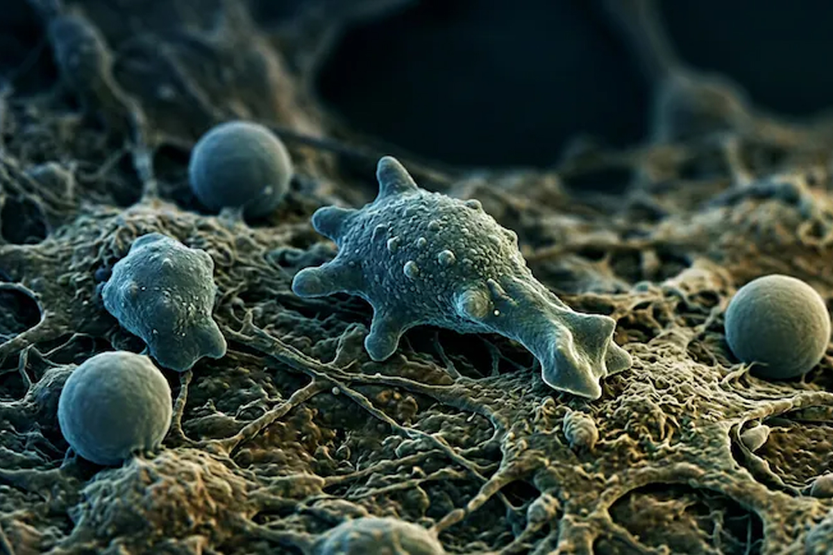 kerala brain eating amoeba 17 deaths what is pam symptoms prevention