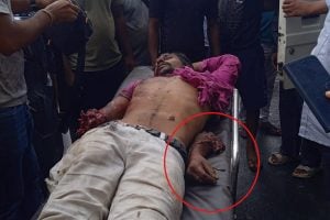 টোটোতে অ্যাম্বুল্যান্সের ধাক্কা, চালকের হাত কেটে পড়ে গেল রাস্তায়! ভয়ংকর কাণ্ড দুর্গাপুরে