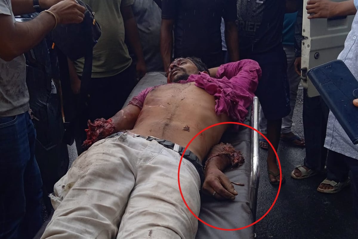 টোটোতে অ্যাম্বুল্যান্সের ধাক্কা, চালকের হাত কেটে পড়ে গেল রাস্তায়! ভয়ংকর কাণ্ড দুর্গাপুরে