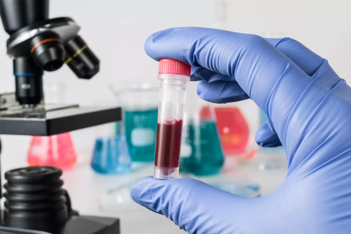 multi cancer blood test launch india